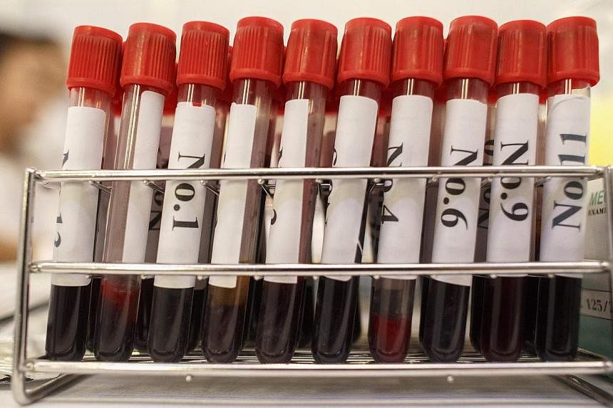 Blood test samples taken as part of a campaign to prevent HIV infection in Bangkok. Fewer than half of all HIV-positive people across the Asia-Pacific region are aware of their status.