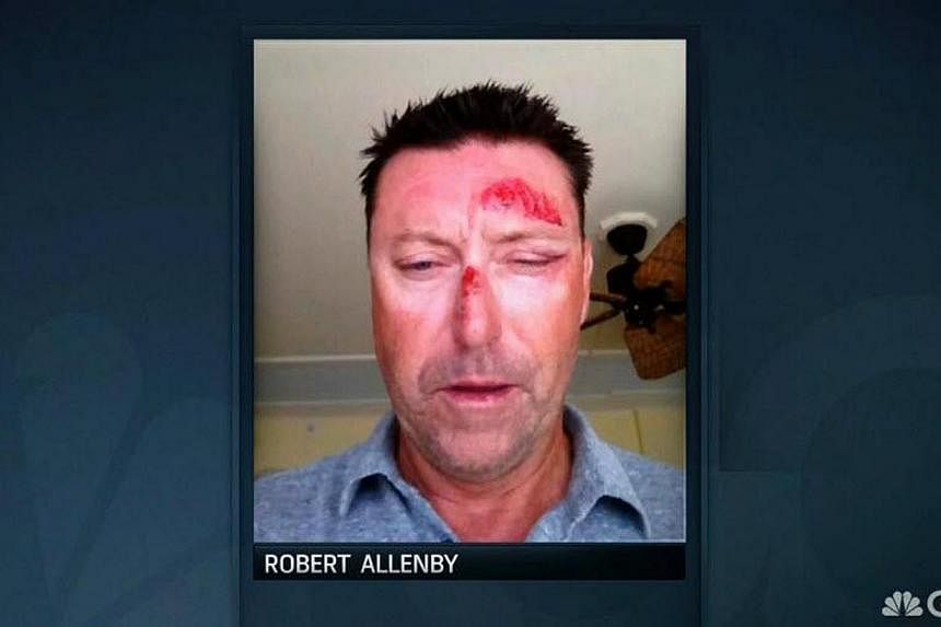 Australian golfer Robert Allenby was recovering on Saturday from facial injuries after he was kidnapped, beaten, robbed and dumped in a park in Honolulu. -- PHOTO:&nbsp;TWITTER/GOLFCHANNEL