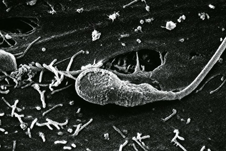 Scanning Electron Micrograph (SEM) of human sperm. Teenage fathers are more likely to have children with health problems because of mutations in their sperm, a study said on Wednesday. -- PHOTO: ST FILE