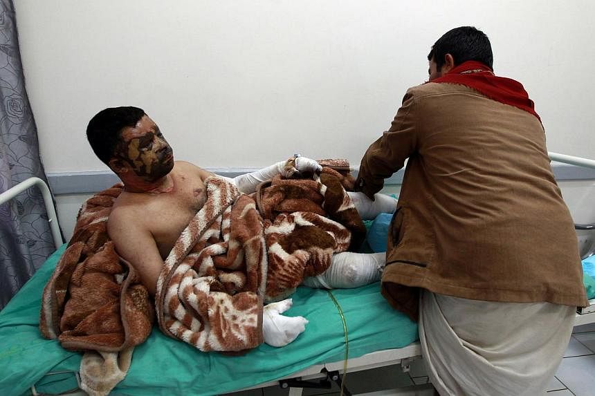 A wounded Yemeni man receives treatment on April 1, 2015, at the burn unit of a hospital in Yemeni capital of Sanaa, following a reported airstrike by the Saudi-led coalition’s in the area of Yarim south of the capital the day before. &nbsp;Dozens 