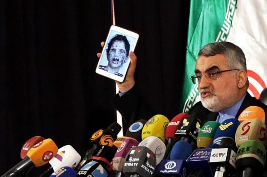 Chairman of the Iranian Shura Council's Committee for Foreign Policy and National Security, Alaeddin Boroujerdi shows an image of an alleged victim of Yemeni fighting during a press conference in Damascus, Syria, on May 14, 2015.&nbsp;&nbsp;Boroujerd