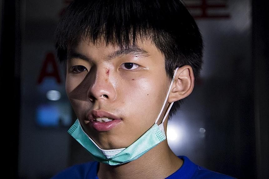 Hong Kong student leader Joshua Wong at a hospital yesterday after he was assaulted on the way home with his girlfriend.