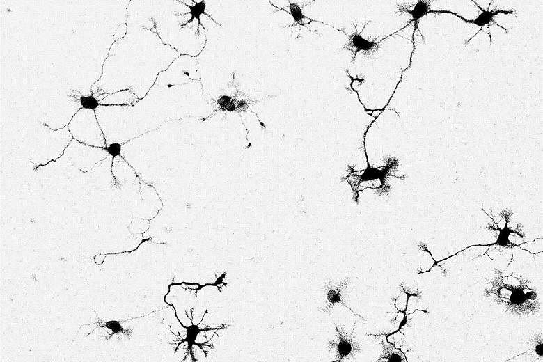 These live neurons, stained with a chemical dye called Neuron Orange, or NeuO, were captured at 20 times magnification under a widefield microscope. The dye is what allows neurons to be distinguished easily from other types of brain cells. NeuO is th