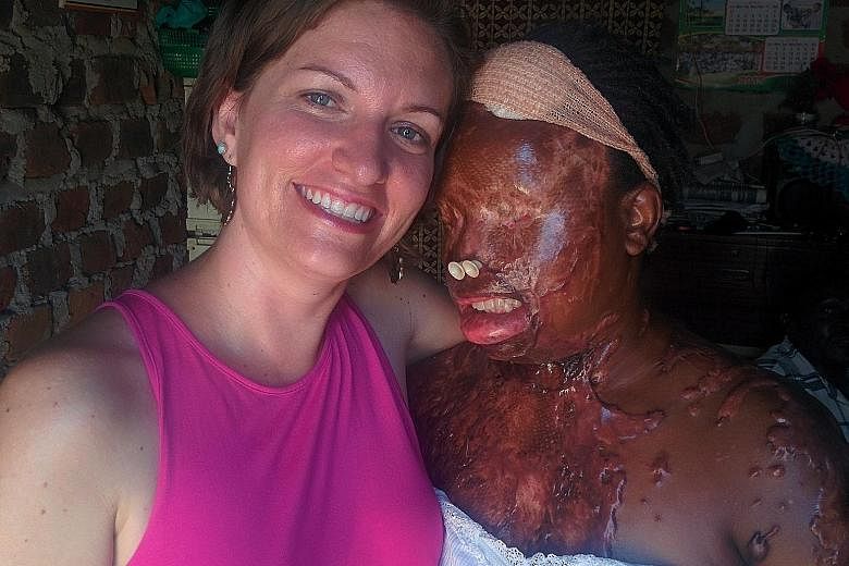 Acid attack victim Namale Allen with social activist Lynsay Lewis.