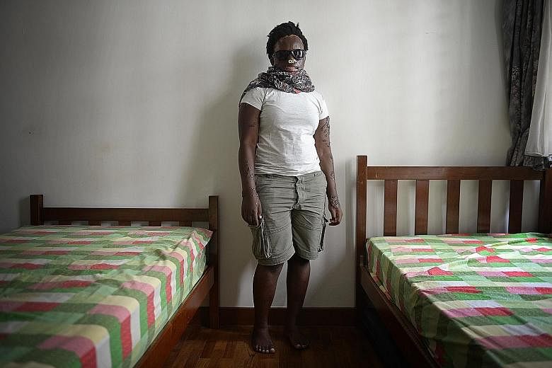 Ms Namale Allen, who was left blind and disfigured after a brutal acid attack in Uganda last year, will go for an operation at TTSH on Thursday to relieve some of the complications which have been plaguing her.