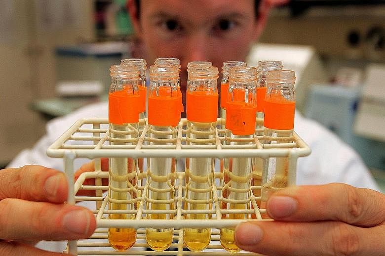 Urine samples being prepared for testing in the Swiss Laboratory for Analysis of Doping.