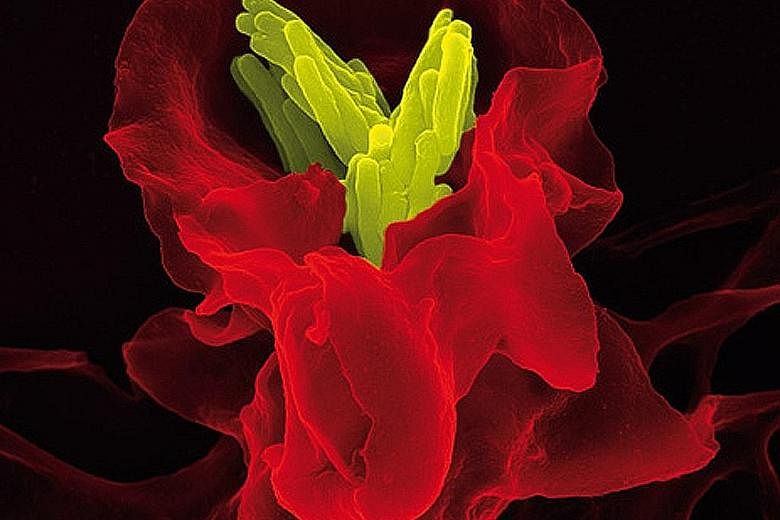 The human immune system in action. This coloured scanning electron microscope image shows a white blood cell (dyed red) in the act of destroying tuberculosis bacteria (yellow).