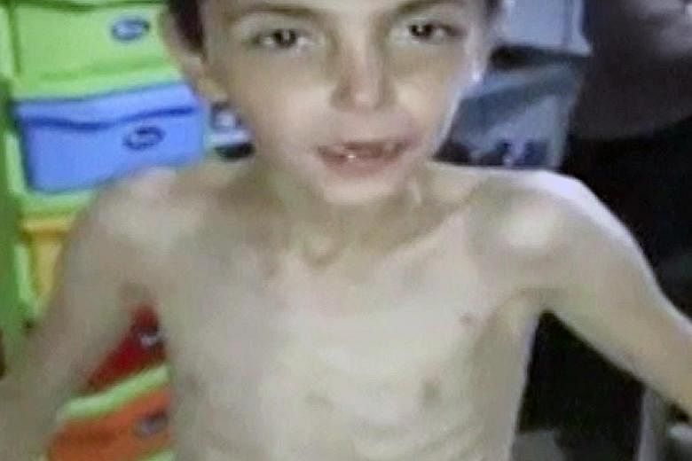 A screengrab from an amateur video showing a boy from rebel-held Madaya, Syria, who said he had not eaten for a week. In recent days, Syrians have been posting photos and videos on social media, sharing stories of people in the town starving and havi