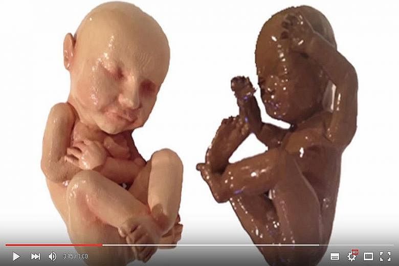 Foetus models (above) and a 3D printed foetus sculpture for the office desk.