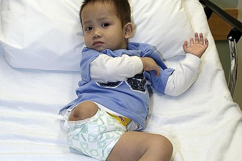 Thien Nhan back in 2009. The abandoned child was mauled by a wild dog.