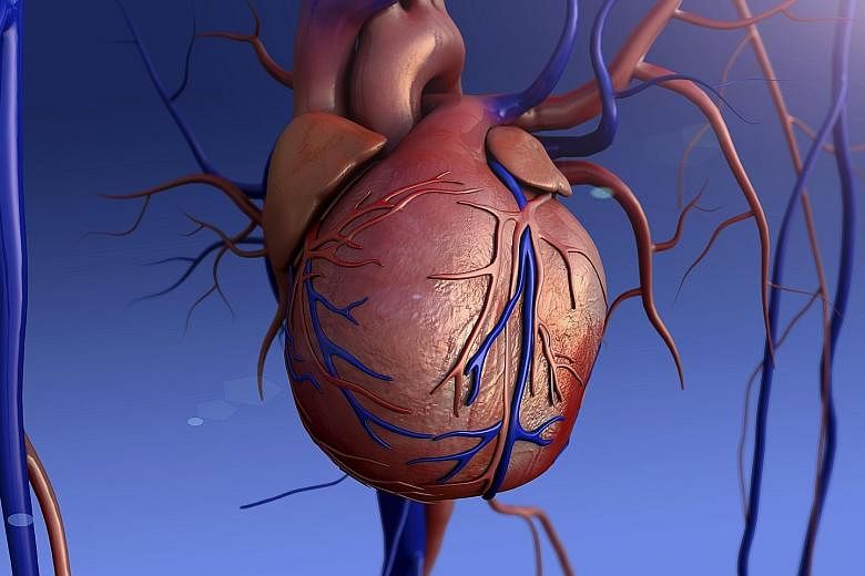 Heart murmurs can be harmless, and are due to increased blood flow through the heart or nearby blood vessels, or they may be due to heart valve disease.