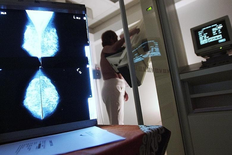 A woman undergoing a mammogram to screen for breast cancer, the prevalent cancer type among women here. The latest cancer report released by the National Registry of Diseases Office estimates that one in four men and one in five women here are likely