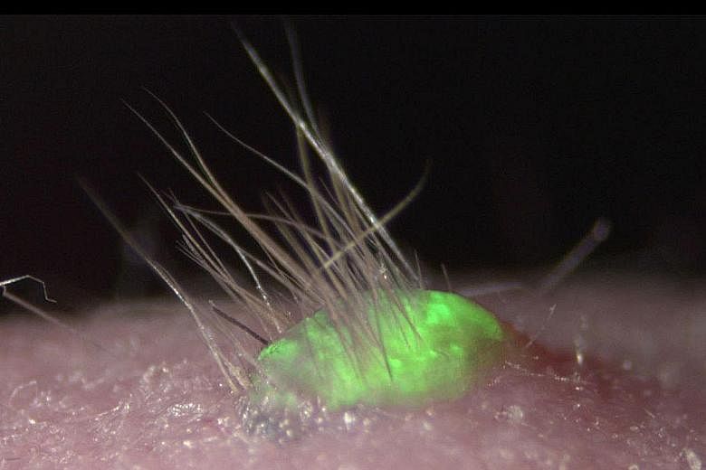 The artificially crafted skin has multiple layers, hair follicles and sweat glands, unlike skin substitutes in the past. The breakthrough raises hope that normal skin could be grown in the future from the cells of burns victims and transplanted back 
