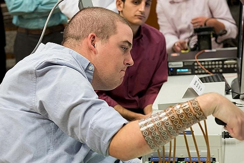 Quadriplegic Ian Burkhart (left), 24, using neural bypass technology to control his arm in this picture released by the Ohio State University Wexner Medical Centre in Columbus, Ohio. The American was left paralysed from the chest down after a diving 