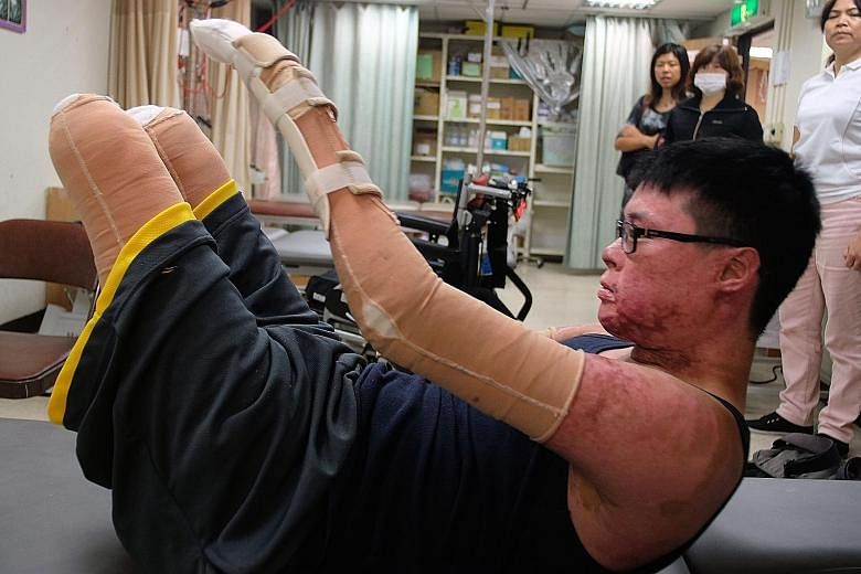 Mr Huang working out at a recovery centre in Taipei. He has decided to rebuild his life and not dwell on the past. Despite his amputations, he insists on doing what used to be simple tasks whenever he can. He eats with a utensil strapped to his bound
