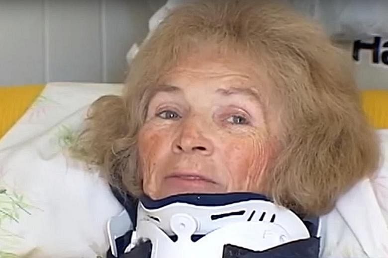 More than two decades after Ms Franco became blind following a car accident, she fell at her home in Florida, hitting her head. The subsequent operation seems to have led to the recovery of her sight.