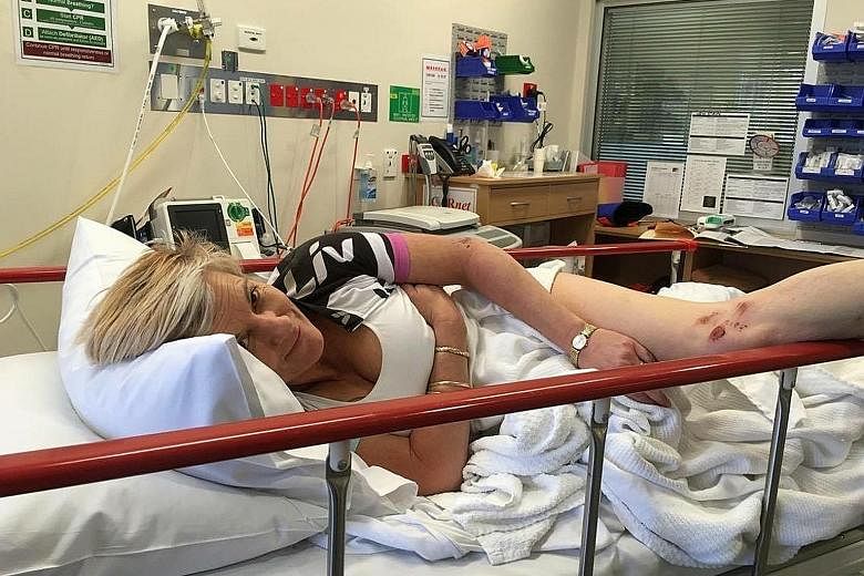 Ms Heinrich said she suffered ruptured breast implants, three cracked ribs and grazes after a kangaroo jumped down from an embankment and landed on her while she was cycling on the Riesling Trail in South Australia's Clare Valley.