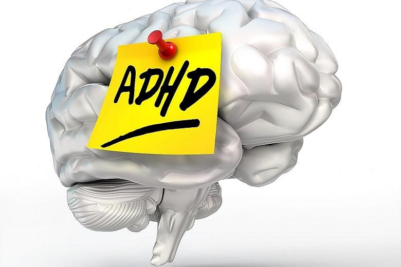 ADHD is caused by a delay in maturation involving parts of the brain responsible for attention control and behaviour inhibition.