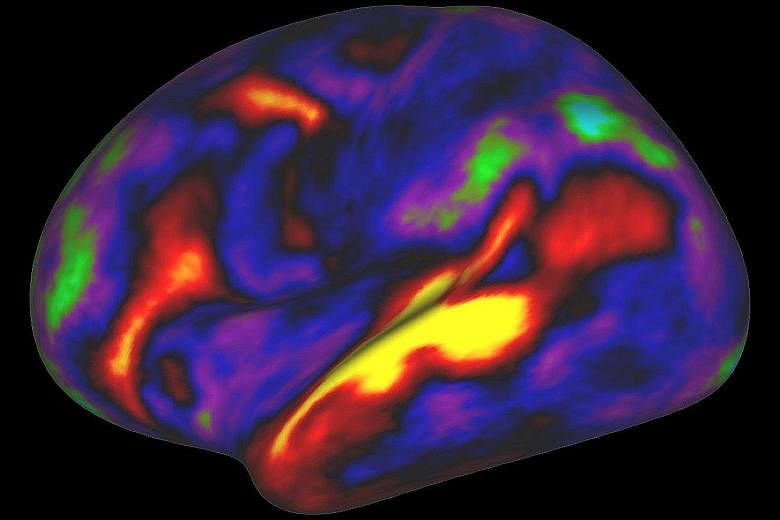An image showing the pattern of brain activation (red and yellow) and deactivation (blue and green) in the brain's left hemisphere when listening to stories in the MRI scanner.