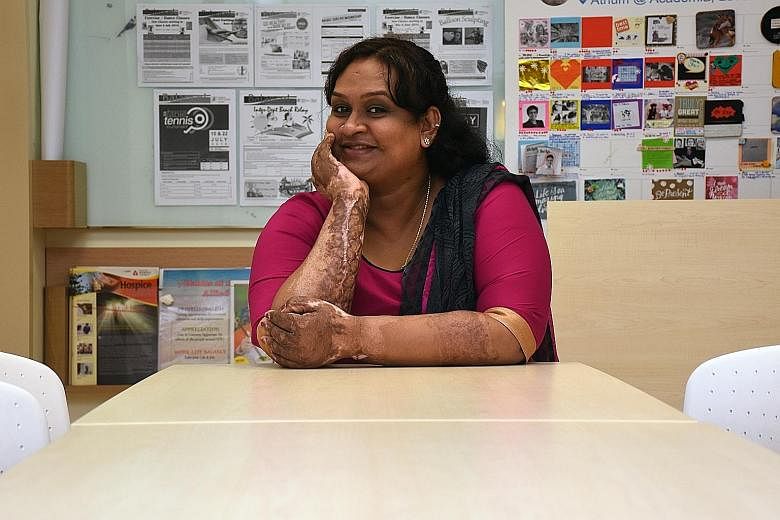 Burn victim Joena Shivani has had nine operations since her accident last year but the recovery process is still far from over. Talking to support groups and other burn survivors has helped her deal with the trauma as well as the isolation that many 
