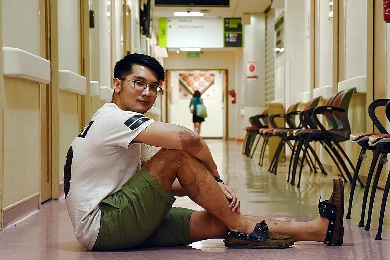 Entrepreneur Jason Lim (above) hopes to help patients with trauma and reach out to burn patients by sharing his story online. He, too, is a burn survivor. He was hospitalised for 44 days in 2014, after a road accident in Cambodia scorched about 20 pe
