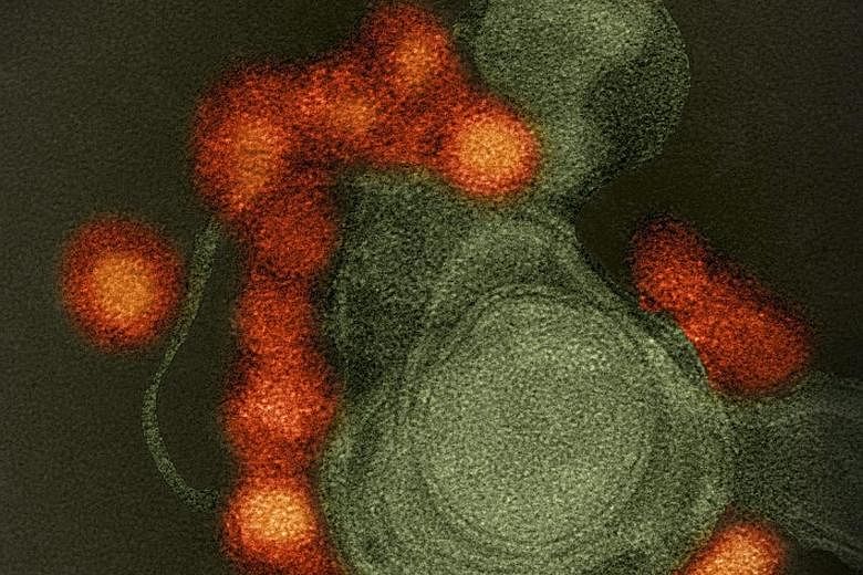 An electron microscope image of the Zika virus (red) infecting a cell. Research conducted on mice shows that the virus could damage adult brain cells critical to learning and memory.