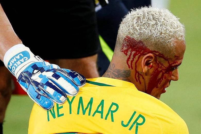 Brazil's Neymar is helped by Bolivia goalkeeper Carlos Lampe after Yasmani Duk leaves the forward with blood pouring from his head.