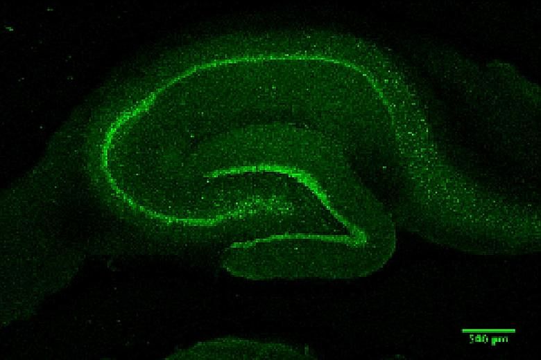 The hippocampus of an aged rat (left) shows higher levels of zinc, highlighted in green, than that of a healthy adult rat (right). While zinc is essential for a body to function well, the researchers found that a high level of zinc in the brain can i