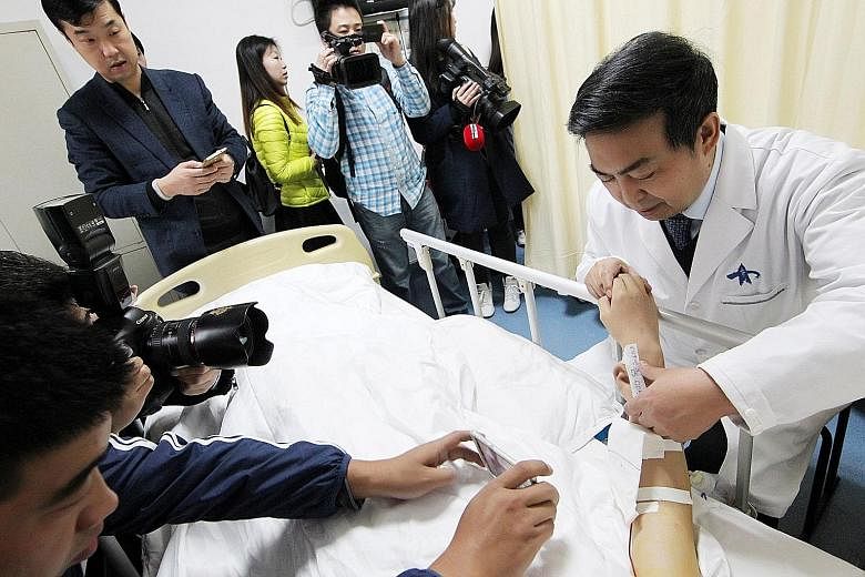 Reporters (left) snapping photos of the "ear" (below) growing on the arm of a man in China who lost his right ear in an accident.