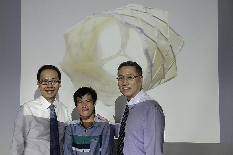 Mr Cheng flanked by Dr Tay (left) and Associate Professor Quek, with a projection of the valve that has been implanted into the patient via a minimally invasive procedure. "The procedure wasn't painful and I can resume my normal activities now," said