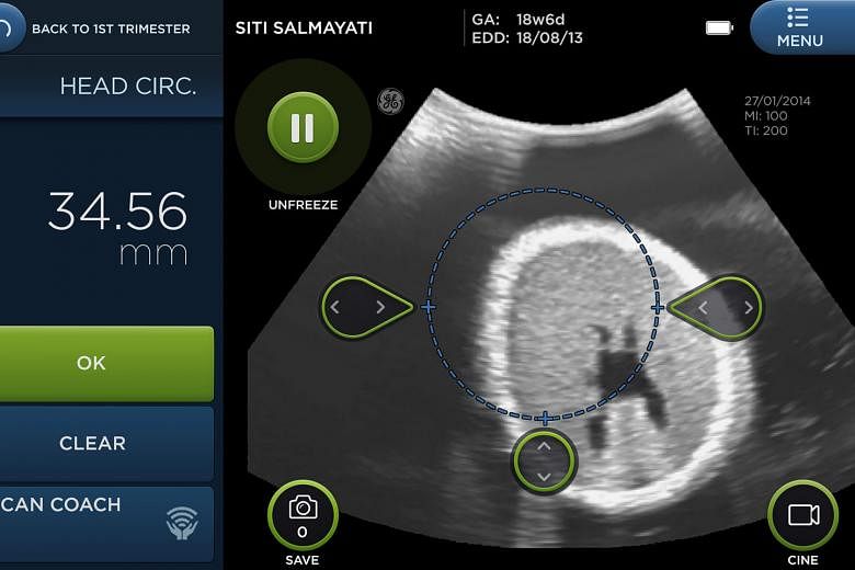 The user interface of the Vscan Access employs design elements that make it look friendly, yet professional, and also easy to use. Field studies have shown that the detection rates of potentially life-threatening conditions in pregnant women improved two-