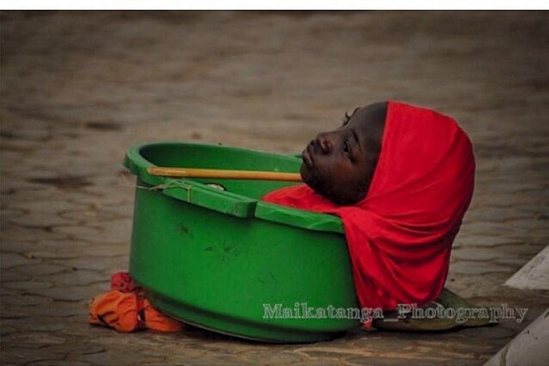 Limbless Nigerian Teen Who Lived In A Plastic Bowl Dies Report The Straits Times