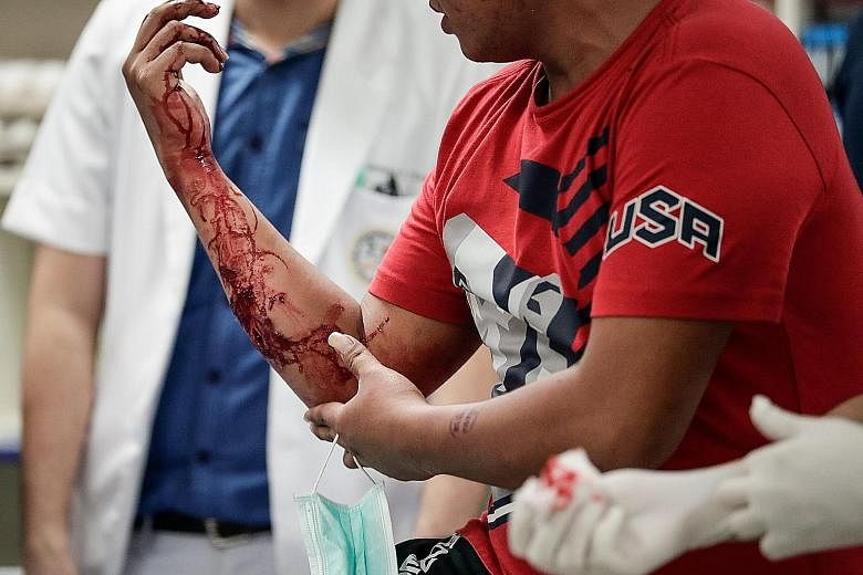 A reveller at a Manila hospital after a fireworks mishap amid the New Year's Eve celebrations.