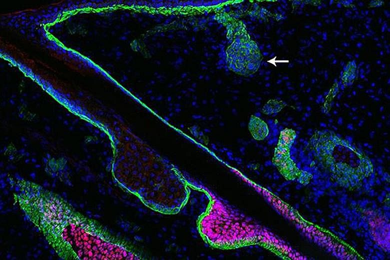 Researchers found that two opposing signalling pathways guide the formation of hair follicles (pink), which emerge first in humans, and sweat glands.