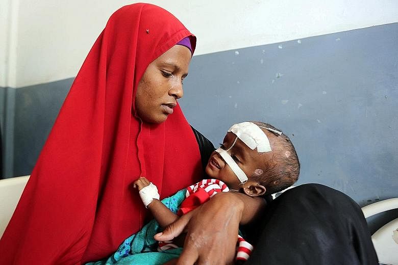 An internally displaced Somali woman holds her malnourished child fitted with a nasogastric tube inside a ward dedicated for diarrhoea patients at the Banadir hospital in Somalia's capital Mogadishu, on March 5. About 6.2 million people in the countr
