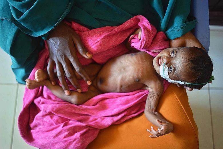 Of the 20 million who are at risk of famine, 1.4 million are children, and they are the most vulnerable.