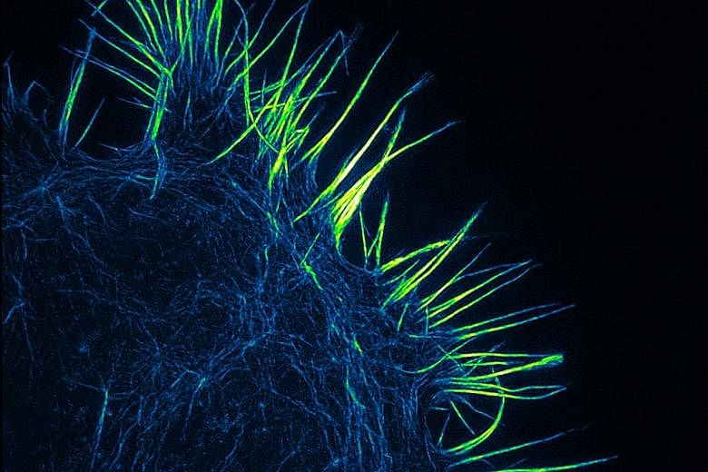Beautiful, yet deadly, a cancer cell probes its environment with spiky protrusions called filopodia in this award-winning picture. Scientists at the Agency for Science, Technology and Research's Institute of Medical Biology used a state-of-the-art su