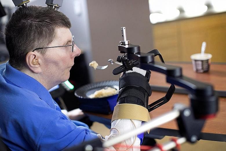 Using a brain interface system, Mr Kochevar, who was paralysed below his shoulders in a cycling accident eight years ago, is now able to move each joint in his right arm individually, just by thinking about it.