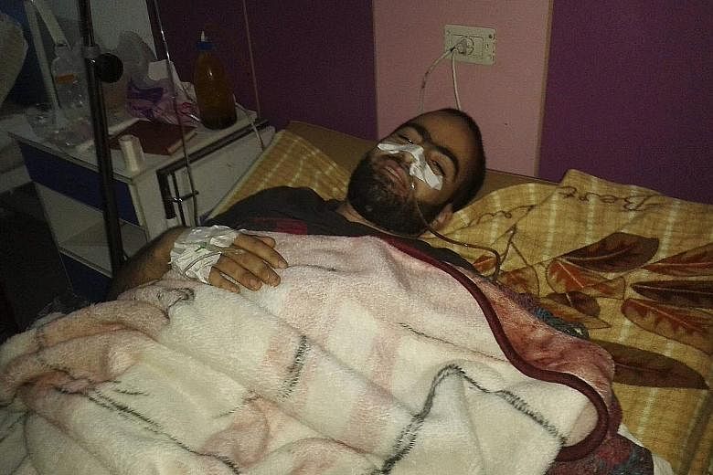 Mr Ebrahim Abbas recovering in a hospital in Syria from a gunshot wound inflicted by a sniper, in an undated photo. He is now in Turkey, and says the US strike on the Syrian regime gives him hope.