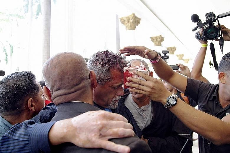 Opposition lawmaker Americo De Grazia being assisted after he was injured in the attack on the National Assembly on Wednesday. The throng of assailants appeared to face no resistance from national guard forces charged with securing the compound.
