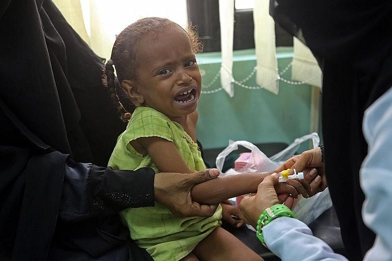 A Yemeni child, who is suspected of being infected with cholera, gets medical attention. On Tuesday, a shipment of chlorine tablets, used for the prevention of cholera, was blocked at Yemen's northern border.