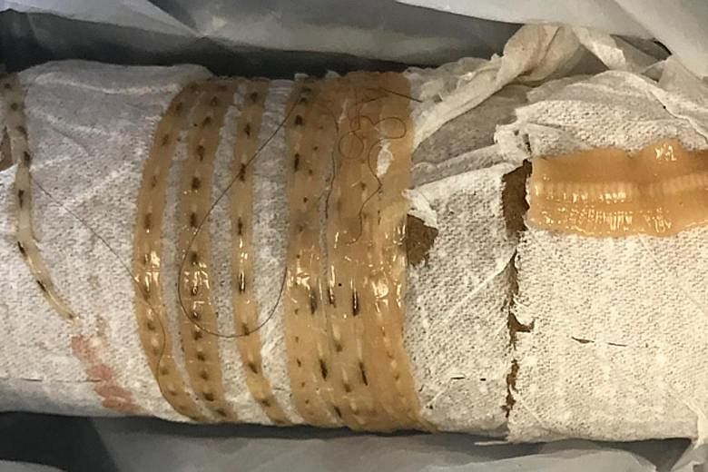 The patient in Fresno, California, wrapped the 1.6m tapeworm around a toilet paper tube after pulling it out of himself last year.
