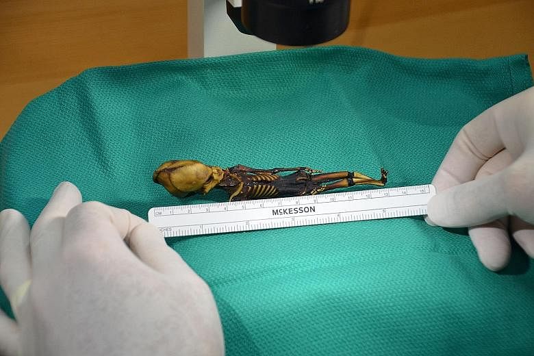 Genetic analysis shows the tiny, mummified skeleton found in 2003 in Chile belonged to an infant girl with a handful of rare gene mutations linked to dwarfism, deformities and apparent premature ageing.