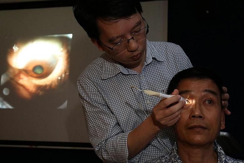 Seri research assistant Tin Aung Tun uses the GonioPEN to diagnose the type of glaucoma in Mr Loke Yew Chong. The GonioPEN (right) compared with a traditional glass gonioscope, which is pressed against a patient's eyeball and is linked to a microscop