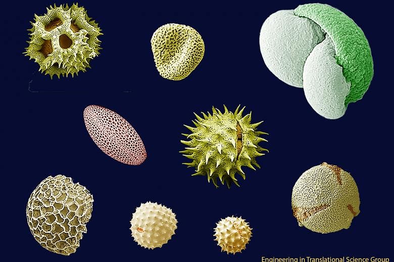 Pollen is thought of as the diamond of the plant world as it is practically indestructible. This image is of pollen grains from various plants including the sunflower, pine and dandelion. Pollen or flower sperm comes in a variety of shapes and sizes,