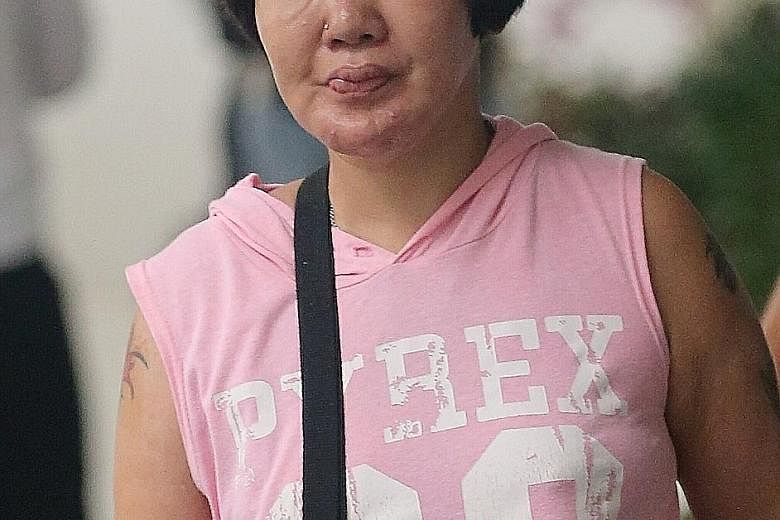 Ms Wendy Tan Li San suffered second-degree burns after her former husband poured hot water on her.
