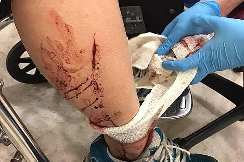 Ms Jenn Low's sister suffered cuts on her right temple, arm and leg after she was knocked down by an e-scooter rider in Bukit Panjang on Tuesday. Ms Low said the rider did not stop or provide help, but fled the scene instead.