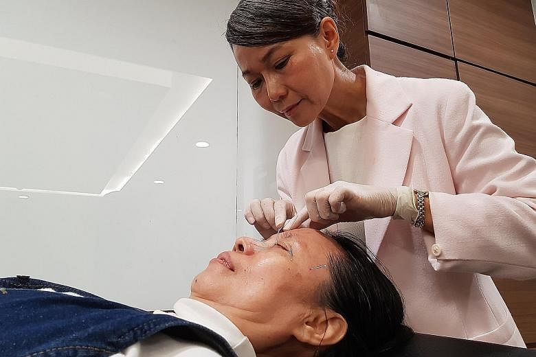 Madam Tan Hwa Moi undergoing acupuncture treatment as part of the clinical trial to treat dry eyes. The study was part of a three-year collaboration between the Singapore Eye Research Institute and Singapore Chung Hwa Medical Institution.