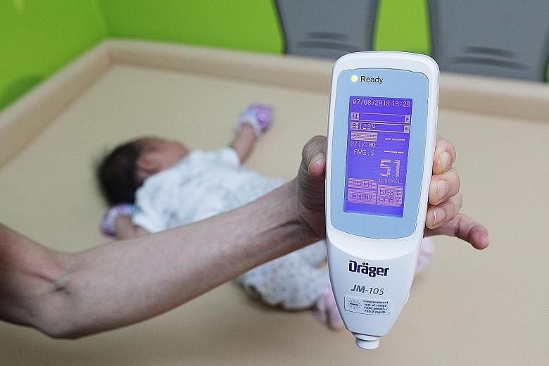 Baby Erina Irwan was screened for jaundice with a transcutaneous bilirubinometer. The new technique is cheaper than the traditional heel prick test, equally accurate and delivers results in a fraction of the time.
