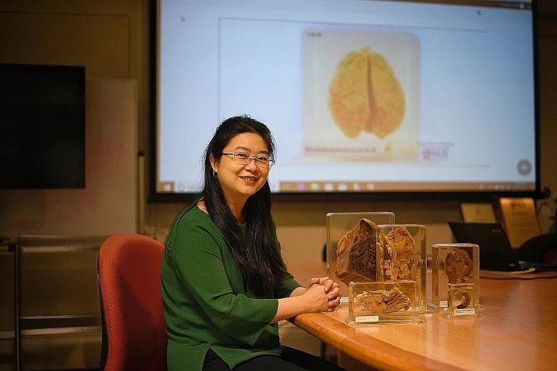 For the past six years, Associate Professor Nga Min En from NUS Yong Loo Lin School of Medicine has been digitising physical specimens of diseased body parts (displayed next to her) and uploading them as part of an online teaching resource called Pat